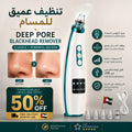Blackhead Remover Vacuum – Deep Pore Cleaner & Acne Extractor
